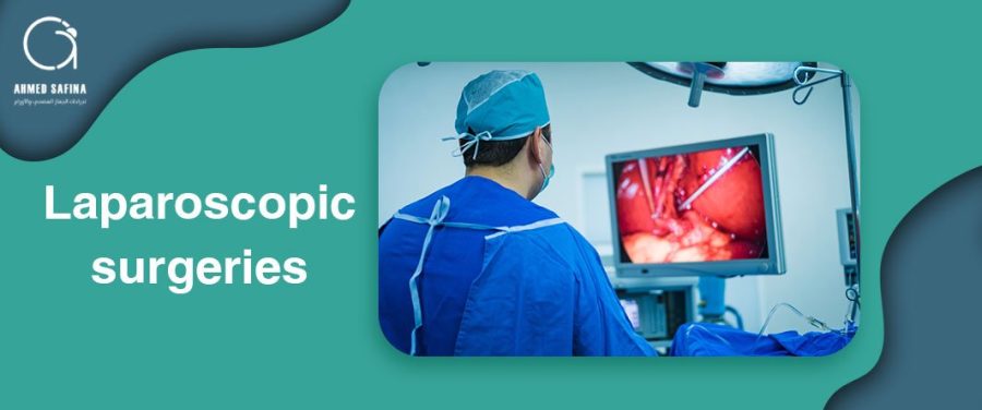 Dr.Ahmed Safina | Laparoscopic surgeries