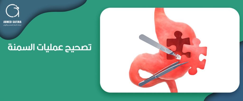 تصحيح عمليات السمنة