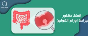 افضل دكتور جراحة اورام القولون