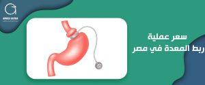 سعر عملية ربط المعدة في مصر