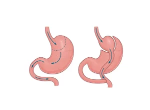 تحويل المسار المصغر