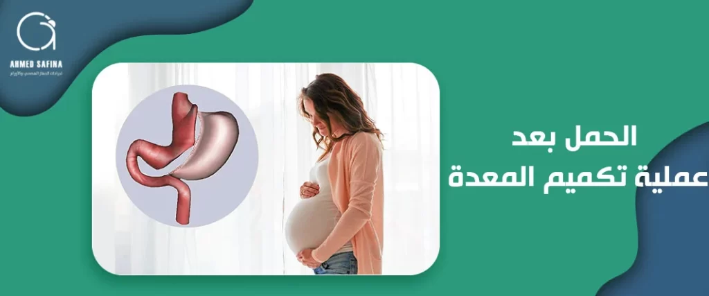 الحمل بعد عملية تكميم المعدة