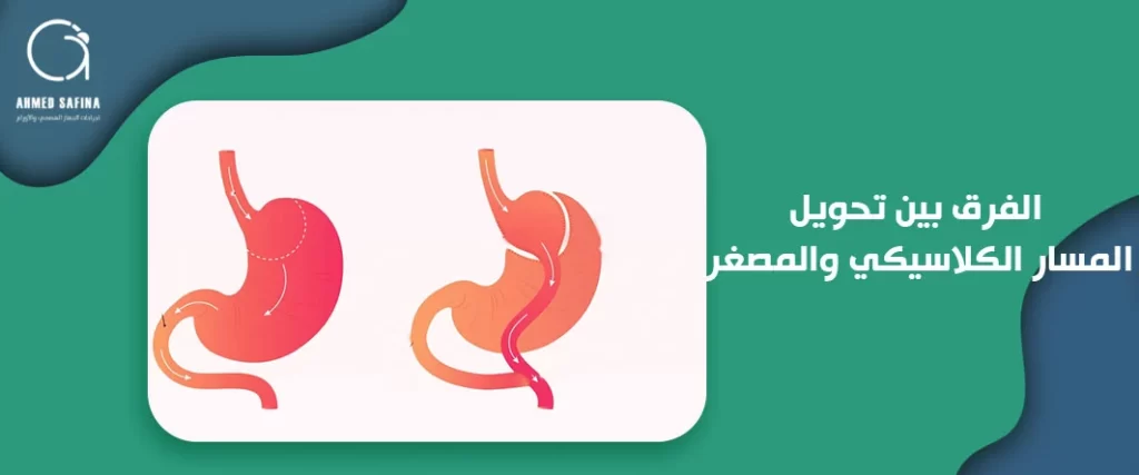الفرق بين تحويل المسار الكلاسيكي والمصغر