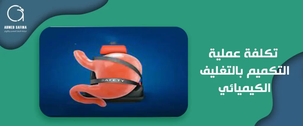 تكلفة عملية تكميم بالتغليف الكيميائي