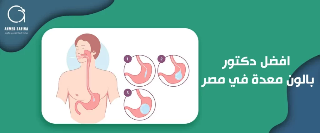 افضل دكتور بالون معدة في مصر