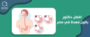 افضل دكتور بالون معدة في مصر