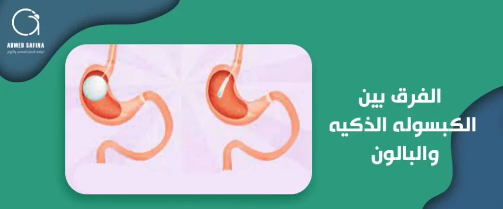 الفرق بين الكبسوله الذكيه والبالون