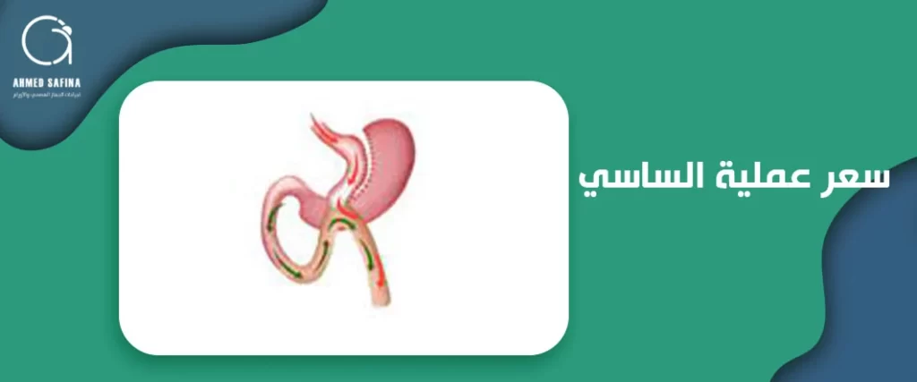 سعر عملية الساسي