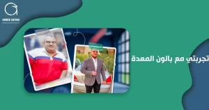تجربتي مع بالون المعدة