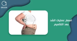اسعار عمليات الشد بعد التكميم