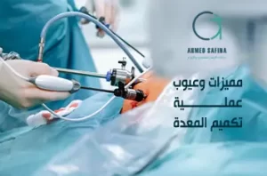 مميزات واضرار عملية تكميم المعدة