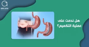 هل ندمت على عملية التكميم؟