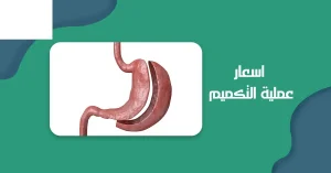اسعار-عملية-التكميم