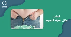 اسباب فشل عملية التكميم