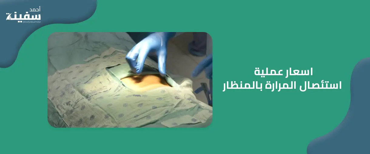 اسعار عملية استئصال المرارة بالمنظار