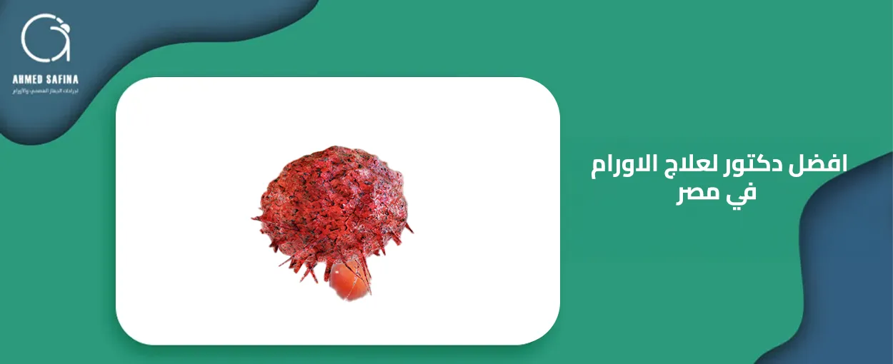 افضل دكتور لعلاج الاورام في مصر