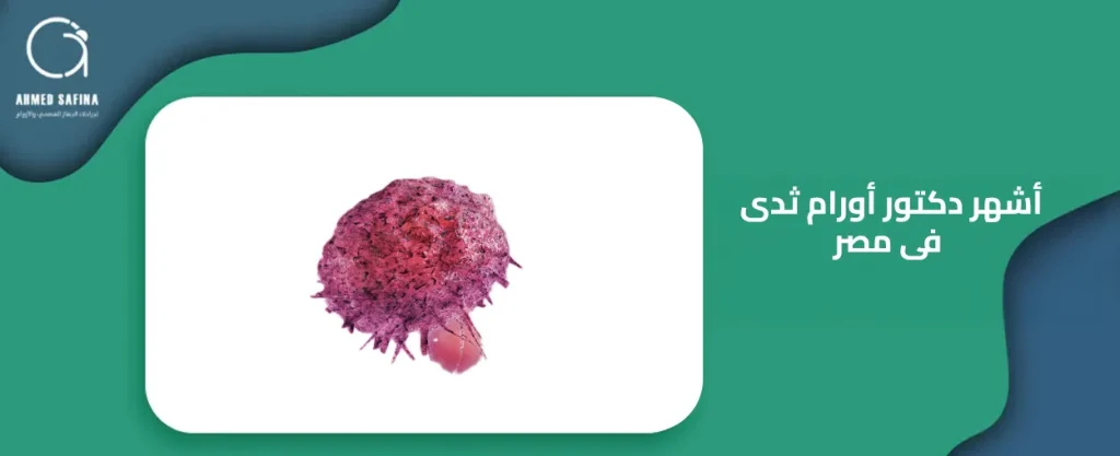 اشهر دكتور اورام ثدى فى مصر