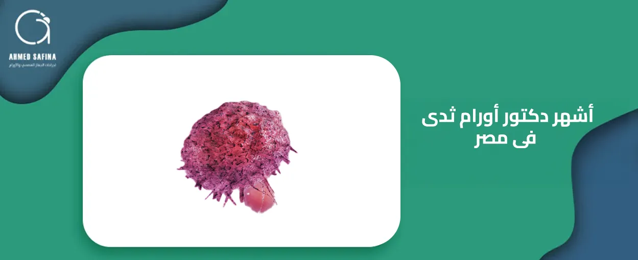 اشهر دكتور اورام ثدى فى مصر