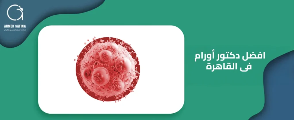 افضل دكتور اورام فى القاهرة