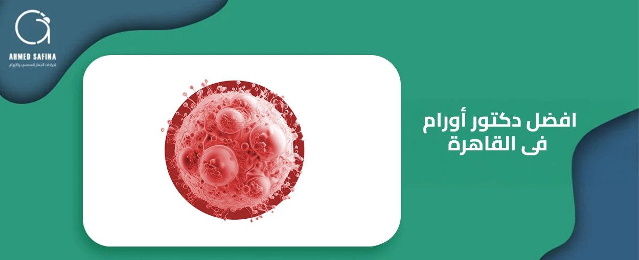 افضل دكتور اورام فى القاهرة