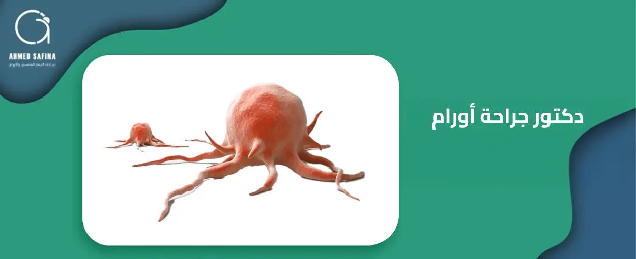 دكتور جراحة اورام