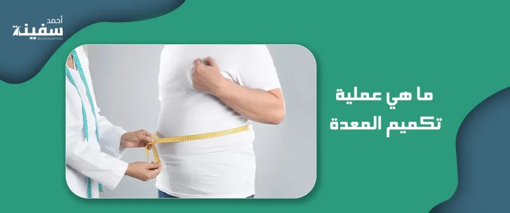 ما هي عملية تكميم المعدة