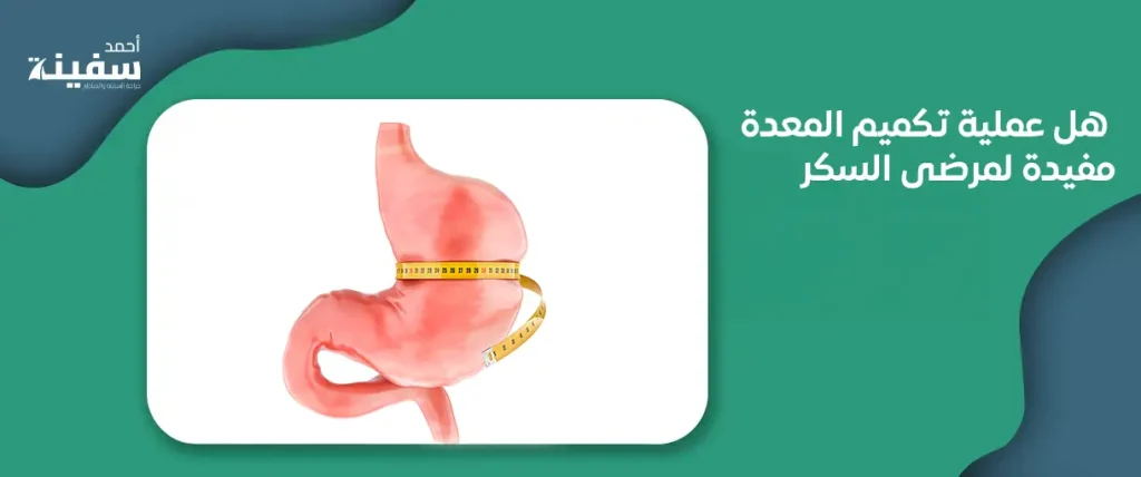 هل عملية تكميم المعدة مفيدة لمرضى السكر؟