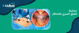 عملية الفتق السري بالمنظار في مصر